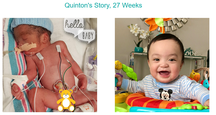 Quinton-27-wks.png Quinton-27-wks.png